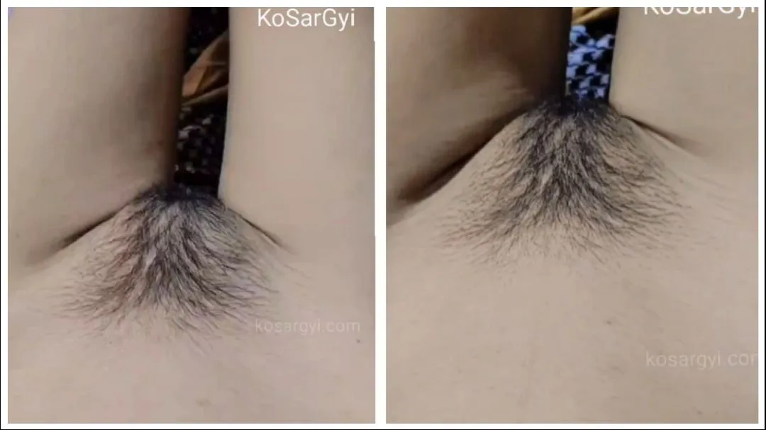 ပူစီ လှလှလေး – Beautiful Pussy